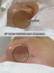 -美肤盾祛痘·问题肌头疗管理中心