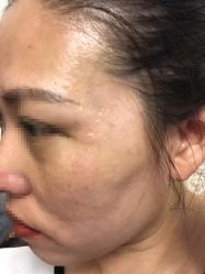 -紫洁俪方（北京）医疗美容
