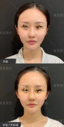 -长沙雅美医疗美容医院