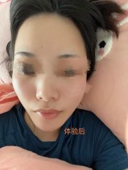 体验后-杭州米兰柏羽医疗美容医院