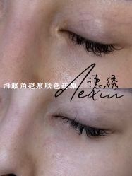 -德绣·机器野生眉发际线·美瞳线半永久