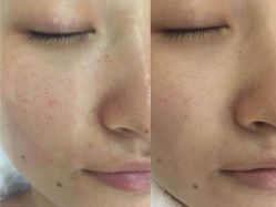 -芳朵美容养生SPA