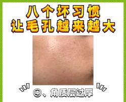 -蕾特恩专业祛痘·皮肤管理