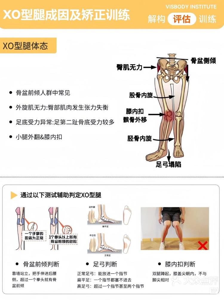 xo型腿矫正图解 最有效图片