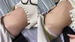 点击看大图 -科技美容&形体美修斯瘦身中心