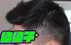 -大麦微针植发丨全国连锁