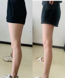 -Lily纤美·科技减脂中心