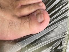-世龙世家灰指甲·甲沟炎·跖疣护理·修脚(东江湾路店)