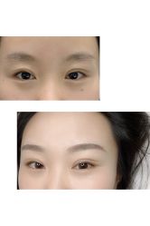 -MIVI半永久纹眉绣眉