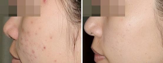 -SKINIST丽铂医疗美容