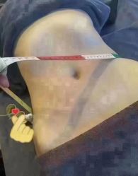 -丽减美瘦吧·减肥瘦身
