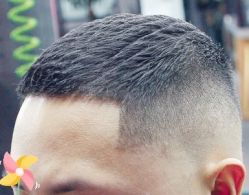 -大麦微针植发丨全国连锁