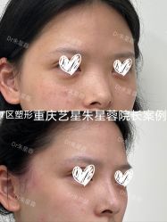 -Yestar重庆艺星医疗美容医院