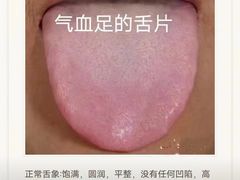 -裕和堂中医推拿艾灸(太古汇臻品店)