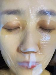 体验后-澳尔颜选医疗美容