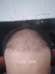 点击看大图 -顺德壹加壹美容医院