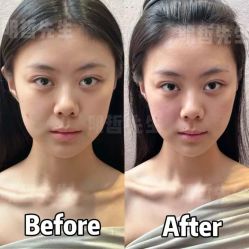 -颜和骨正&明星徒手小颜整骨