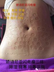 -娇诗尼亚科技健康spa美体连锁