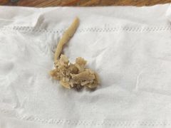 -苏生镇江鸭血粉丝(永泰国际广场店)