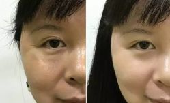 -上海时光整形外科医院