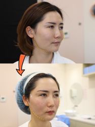 -上海时光整形外科医院