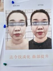 -菊子小颜·日式整骨·产后管理