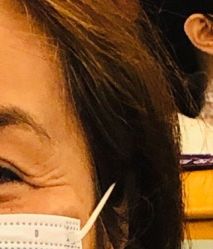 体验前-天津伊美尔医疗整形美容专科医院