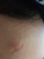 -丽美妍医疗美容·皮秒·立体分层抗衰