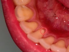 -深圳佑诺口腔门诊部