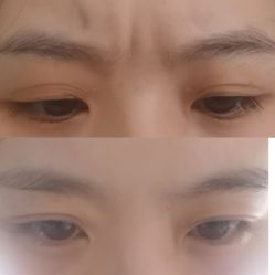 体验前-杭州医巢医疗美容
