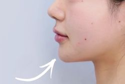 -天津健丽·去眼袋医疗美容机构