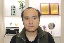 -大麦微针植发丨全国连锁