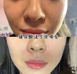 -上海漾颜医疗美容
