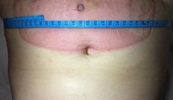 -肥三针腧穴瘦身馆