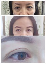 做前 、做后、是不是锦上添花？-平萍纹绣韩式半永久定妆