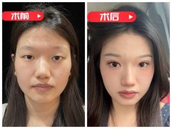 -素美医疗美容·西南眼鼻整形·修复基地