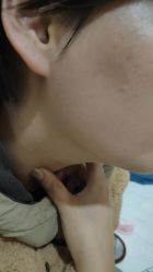 -北京美痣堂古方祛痣斑疣瘊