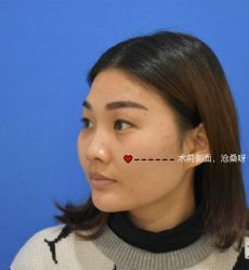 -天津健丽·去眼袋医疗美容机构