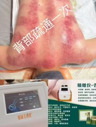 -丽减美瘦吧·减肥瘦身
