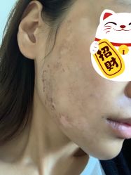 点击看大图 -美壹生诊所皮肤管理中心·海菲秀&Legacy美白舱