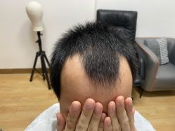 -发饰美男士增发补发假发定制店