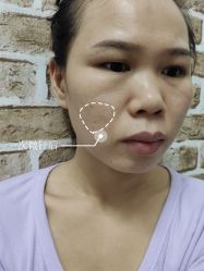 -深圳春天阳光医院·轮廓抗衰中心