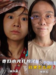 -八大处整形