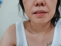 -海涛医疗美容·面部抗衰·注射美鼻