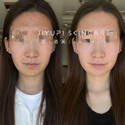 点击看大图 -MLP美丽派·问题肌疗愈中心