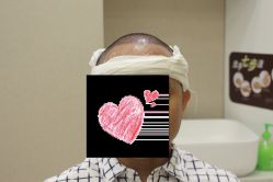 -大麦微针植发丨全国连锁