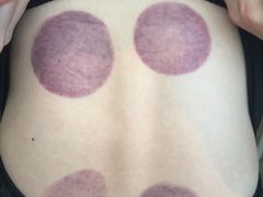 -太乙盲人推拿按摩连锁(星洲店)