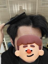 -大麦微针植发丨全国连锁