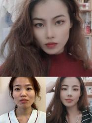-北京米扬丽格医疗美容·联合丽格鼻整形中心