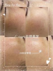 -E.beauty驻颜·痘敏肌调理中心